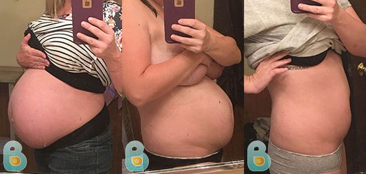 387-Jordan-H-Bellefit-Results-Before-and-After-Bellefit-SLIDE