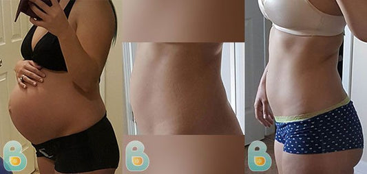 388-Erin-F-Bellefit-Results-Before-and-After-Bellefit-SLIDE