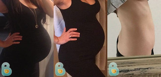 389-Meliss-S-Bellefit-Results-Before-and-After-Bellefit-SLIDE