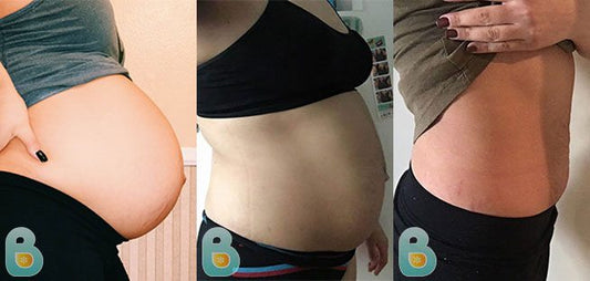 390-Janet-B-Bellefit-Results-Before-and-After-Bellefit-SLIDE