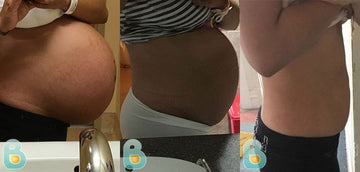 391-Veronica-R-Bellefit-Results-Before-and-After-Bellefit-SLIDE