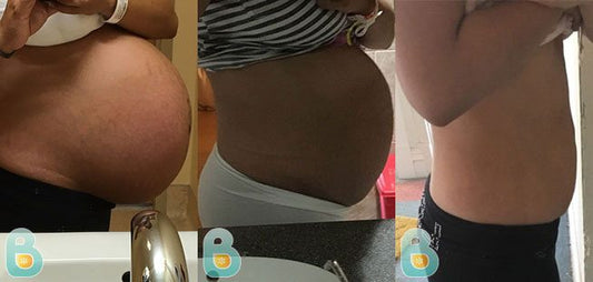 391-Veronica-R-Bellefit-Results-Before-and-After-Bellefit-SLIDE