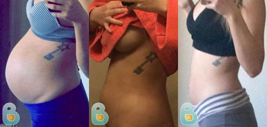 392-Mary-S-Bellefit-Results-Before-and-After-Bellefit-SLIDE