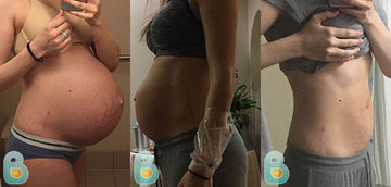 393-Zoe-B-Bellefit-Results-Before-and-After-Bellefit-SLIDE