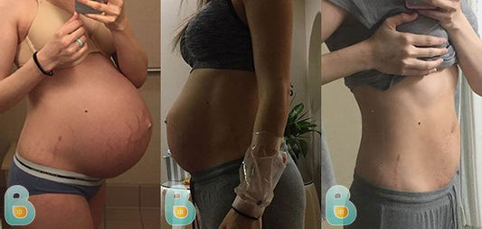 393-Zoe-B-Bellefit-Results-Before-and-After-Bellefit-SLIDE