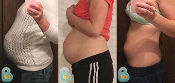 395-Jessica-M-Bellefit-Results-Before-and-After-Bellefit-SLIDE