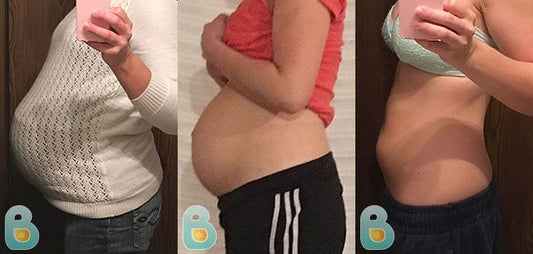 395-Jessica-M-Bellefit-Results-Before-and-After-Bellefit-SLIDE