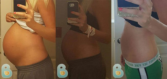 396-Kayla-W-Bellefit-Results-Before-and-After-Bellefit-SLIDE
