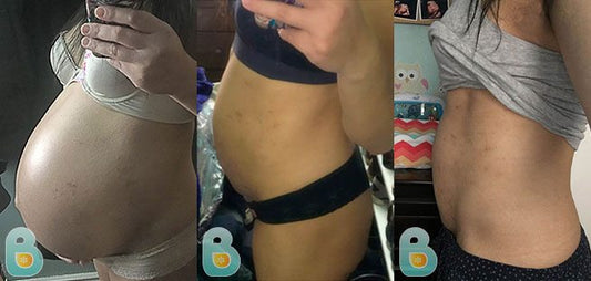 397-Starlette-P-Bellefit-Results-Before-and-After-Bellefit-SLIDE