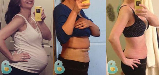 4-Amanda-H-Bellefit-Results-Before-and-After-Bellefit-SLIDE