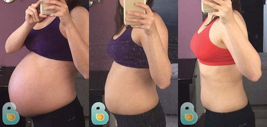 40-Cristina-M-Bellefit-Results-Before-and-After-Bellefit-SLIDE