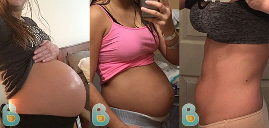 400-Marjorie-B-Bellefit-Results-Before-and-After-Bellefit-SLIDE