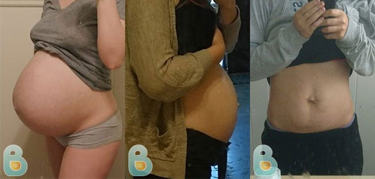 401-Kristina-W-Bellefit-Results-Before-and-After-Bellefit-SLIDE