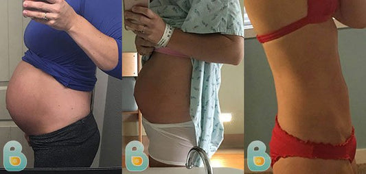 403-Valerie-L-Bellefit-Results-Before-and-After-Bellefit-SLIDE