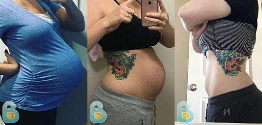 404-Elizabeth-W-Bellefit-Results-Before-and-After-Bellefit-SLIDE