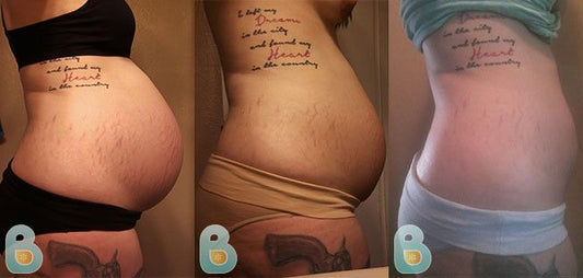 406-Ashley-M-Bellefit-Results-Before-and-After-Bellefit-SLIDE