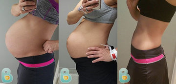 413-Cherie-D-Bellefit-Results-Before-and-After-Bellefit-SLIDE