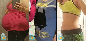 415-Yadira-A-Bellefit-Results-Before-and-After-Bellefit-SLIDE