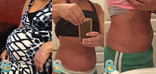 42-Dahlia-G-Bellefit-Results-Before-and-After-Bellefit-SLIDE