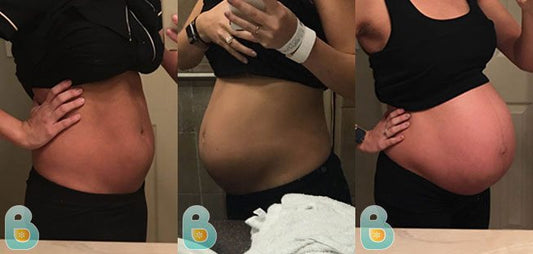 424-Crystal-D-Bellefit-Results-Before-and-After-Bellefit-SLIDE