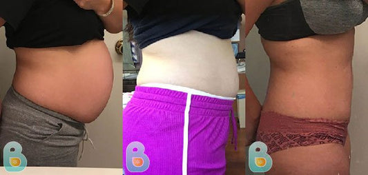 425-Maranda-M-Bellefit-Results-Before-and-After-Bellefit-SLIDE