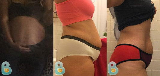 426-Erika-G-Bellefit-Results-Before-and-After-Bellefit-SLIDE