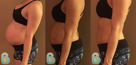 427-Maritza-C-Bellefit-Results-Before-and-After-Bellefit-SLIDE