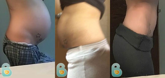 428-Erin-Q-Bellefit-Results-Before-and-After-Bellefit-SLIDE