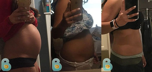 429-Kathrina-M-Bellefit-Results-Before-and-After-Bellefit-SLIDE