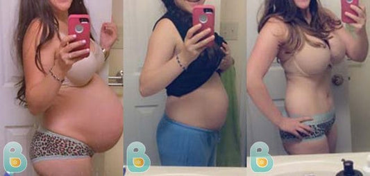 43-Dani-S-Bellefit-Results-Before-and-After-Bellefit-SLIDE