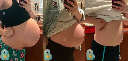 431-Justine-M-Bellefit-Results-Before-and-After-Bellefit-SLIDE