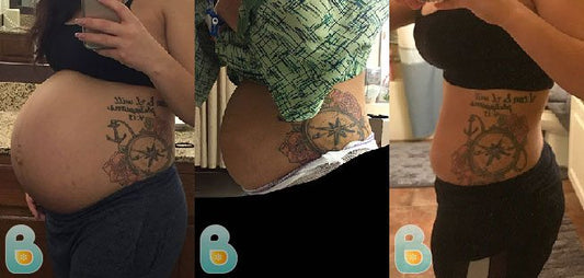 433-Kimberly-Q-Bellefit-Results-Before-and-After-Bellefit-SLIDE
