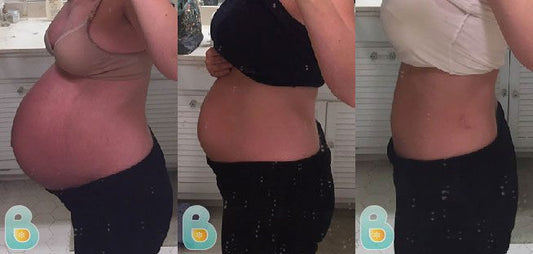434-Stephanie-D-Bellefit-Results-Before-and-After-Bellefit-SLIDE