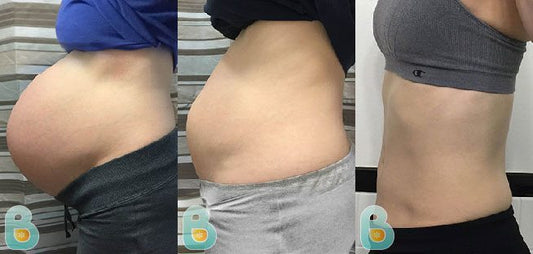 435-Kim-M-Bellefit-Results-Before-and-After-Bellefit-SLIDE