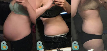 437-Stacey-H-Bellefit-Results-Before-and-After-Bellefit-SLIDE