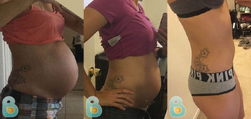 438-Milena-N-Bellefit-Results-Before-and-After-Bellefit-SLIDE