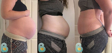 441-Erin-S-Bellefit-Results-Before-and-After-Bellefit-SLIDE