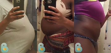 444-Oluwamuyade-A-Bellefit-Results-Before-and-After-Bellefit-SLIDE