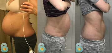 446-Ashley-N-Bellefit-Results-Before-and-After-Bellefit-SLIDE