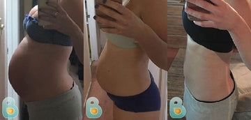 449-Raia-A-Bellefit-Results-Before-and-After-Bellefit-SLIDE