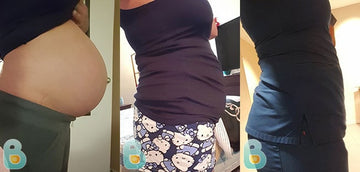 454-Patricia-R-Bellefit-Results-Before-and-After-Bellefit-SLIDE