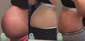 457-Gwen-L-Bellefit-Results-Before-and-After-Bellefit-SLIDE