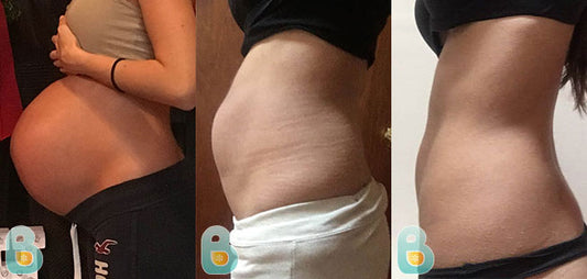 463-Crystal-M-Bellefit-Results-Before-and-After-Bellefit-SLIDE