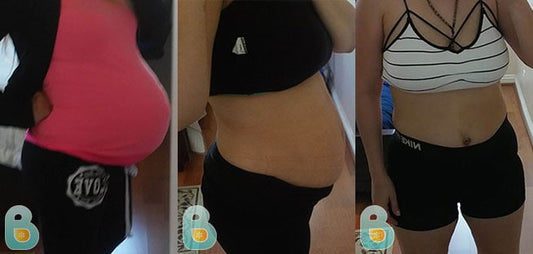 464-Leticia-L-Bellefit-Results-Before-and-After-Bellefit-SLIDE