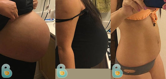 465-Gloria-T-Bellefit-Results-Before-and-After-Bellefit-SLIDE