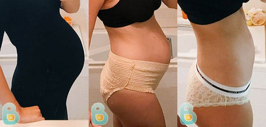 466-Christine-A-Bellefit-Results-Before-and-After-Bellefit-SLIDE