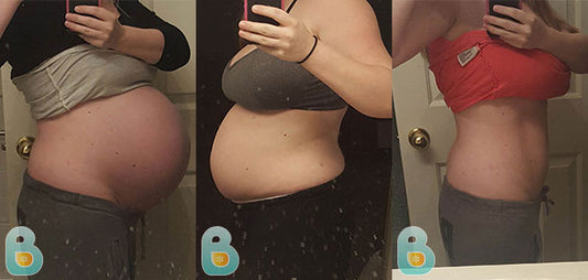 467-Jesi-M-Bellefit-Results-Before-and-After-Bellefit-SLIDE