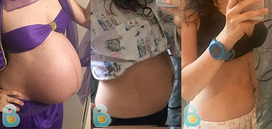 468-Tiffany-N-Bellefit-Results-Before-and-After-Bellefit-SLIDE