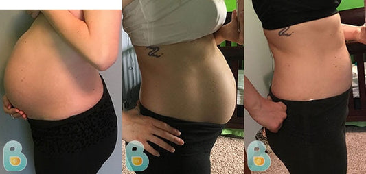 469-Staci-B-Bellefit-Results-Before-and-After-Bellefit-SLIDE
