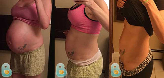 470-Renee-D-Bellefit-Results-Before-and-After-Bellefit-SLIDE